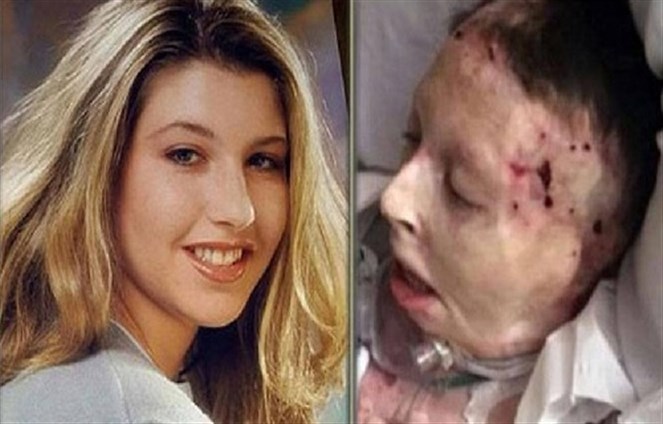 حرقها عشيقها عمداً.. والسبب لا يقبله عقل شاهد بنفسك لتعرف سبب ذالك وكيف نجت