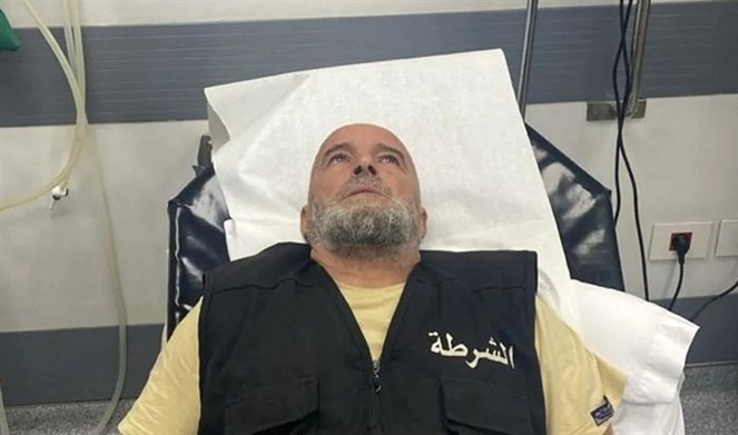 tayyar.org - ماذا حصل في أنفه ليلًا؟ (صورة)